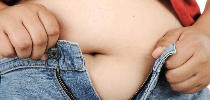 Les varices, un mal lié à l'obésité