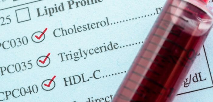 Triglycérides élevés : 4 méthodes pour faire baisser un taux excessif