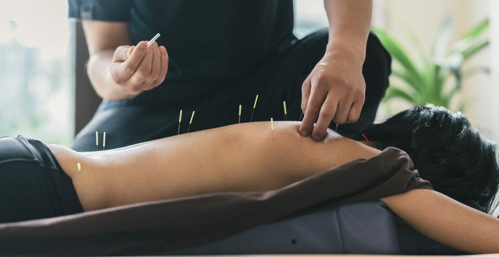 L'acupuncture, idéale à la ménopause
